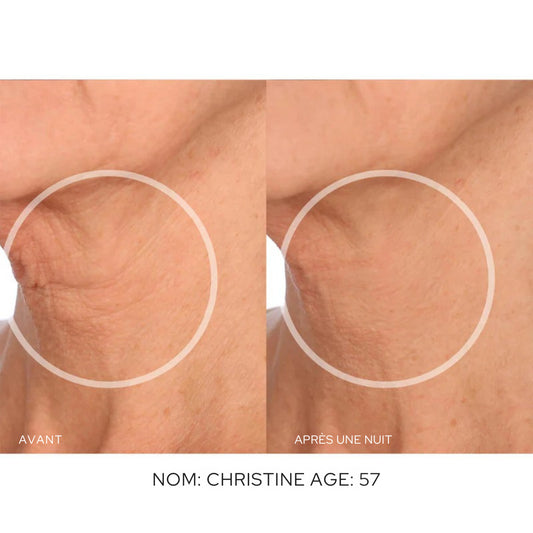 Patchs Anti-Rides Visage - Skinly™