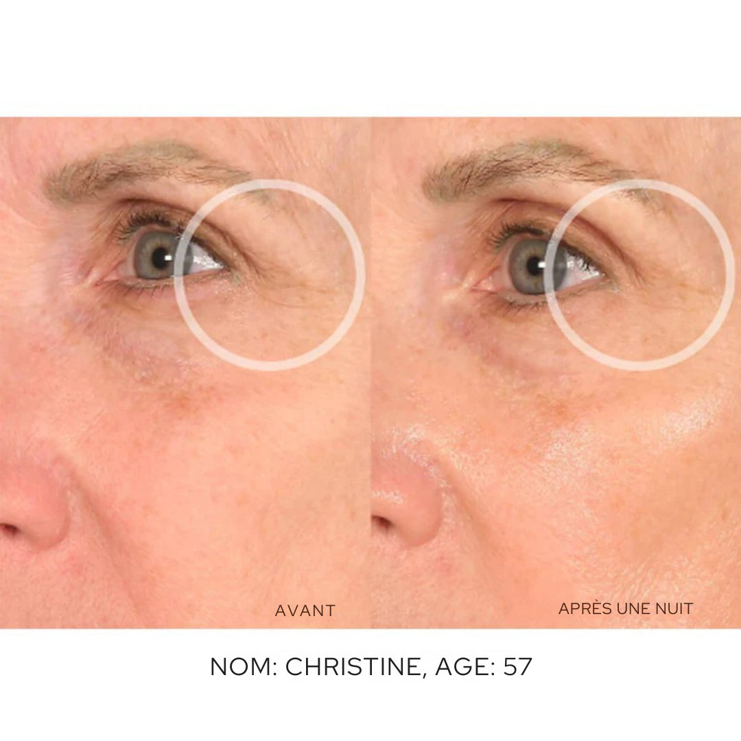 Patchs Anti-Rides Visage - Skinly™