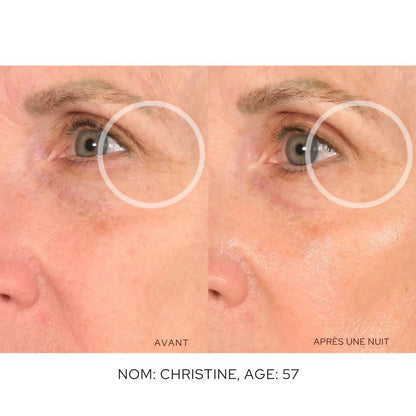 Patchs Anti-Rides Visage - Skinly™
