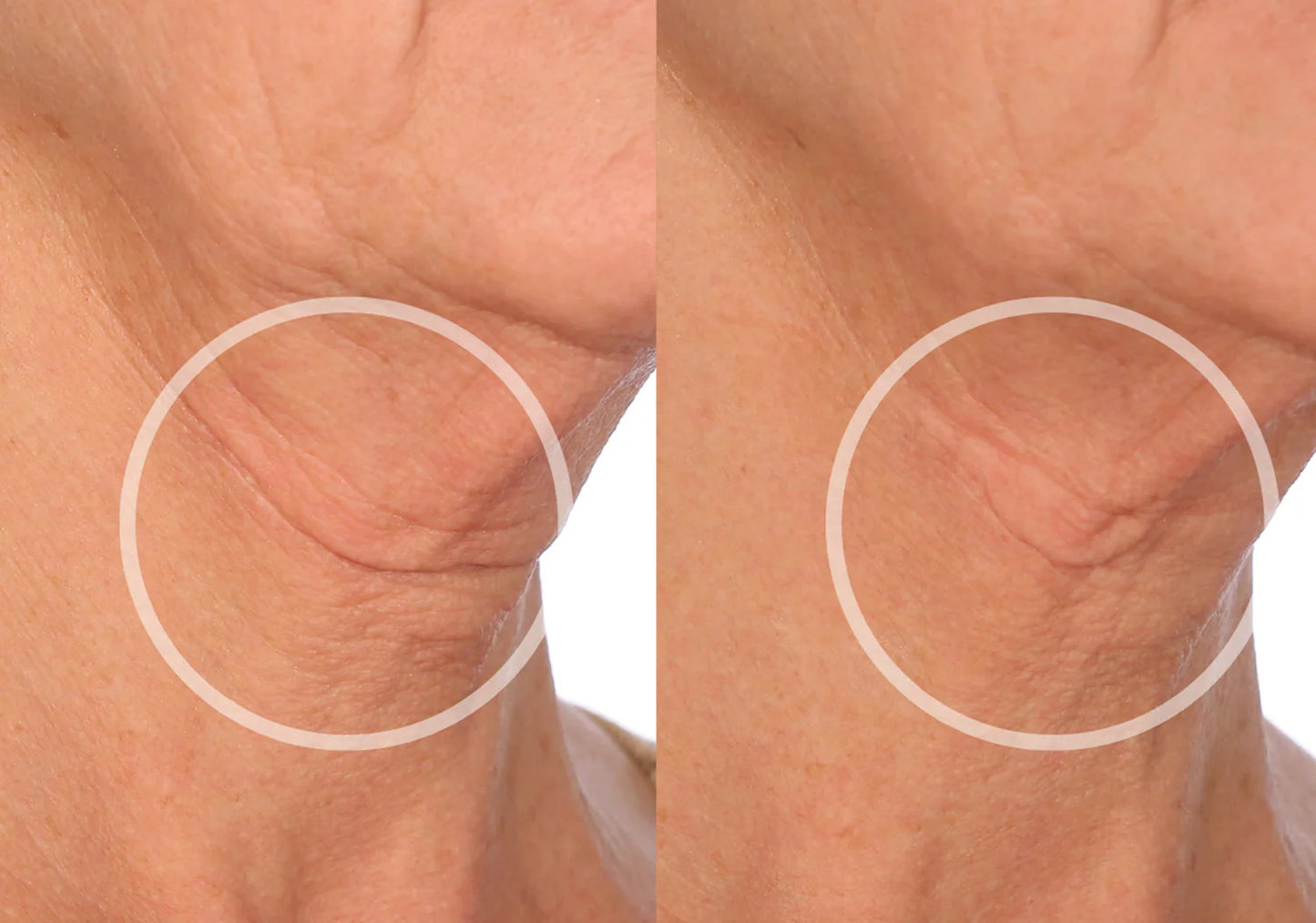 Patch Cou - Skinly™
